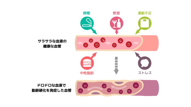 成人病予防にキダチアロエの効果効能